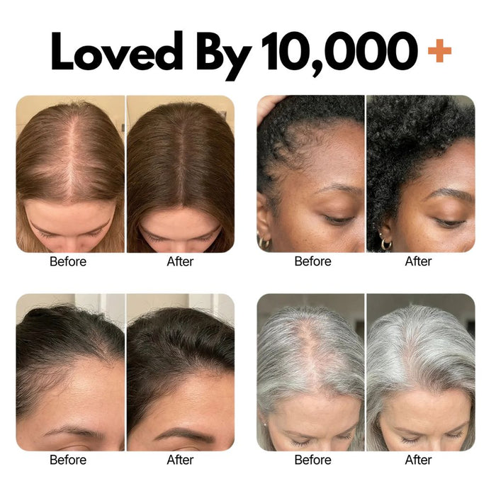 Korea's #1 Growturn Hair Brush Serum