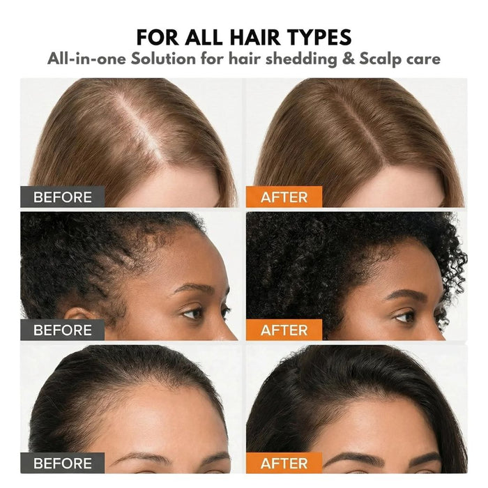 Korea's #1 Growturn Hair Brush Serum